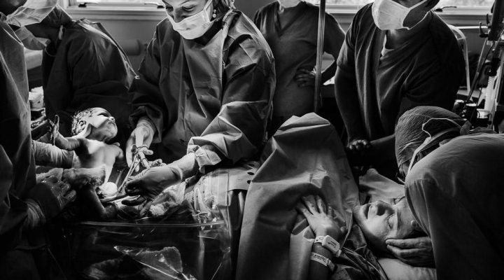 fotografia de parto premiada melhor fotógrafo de parto